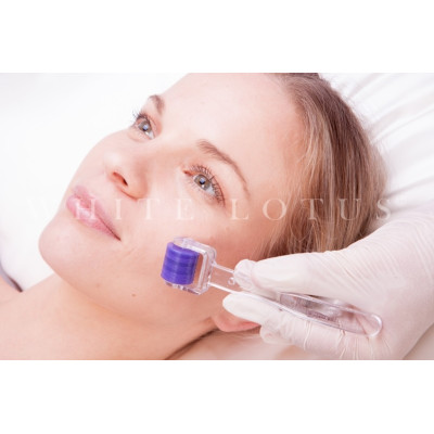 White Lotus Anti Aging Dermaroller Lotus Roller™ — Tratamiento White Lotus Anti Aging Dermaroller Lotus Roller™ — Tratamiento